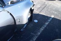 My Accident Pics (Look Only If You Want)-za2_sm.jpg