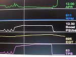 woohoo! best results yet!-3rda.jpg