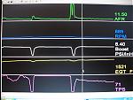 woohoo! best results yet!-2rd25th.jpg