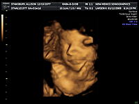Random Pics..Your Z, other toys, kids, girlfriend, wife, your self....-baby_2.jpg