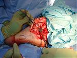 deadcop survived surgery last night-pc080068-2-.jpg